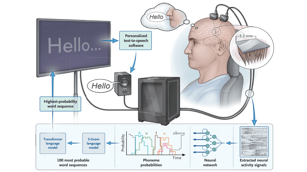 A man with electrodes connected through his skull is connected to a machine.